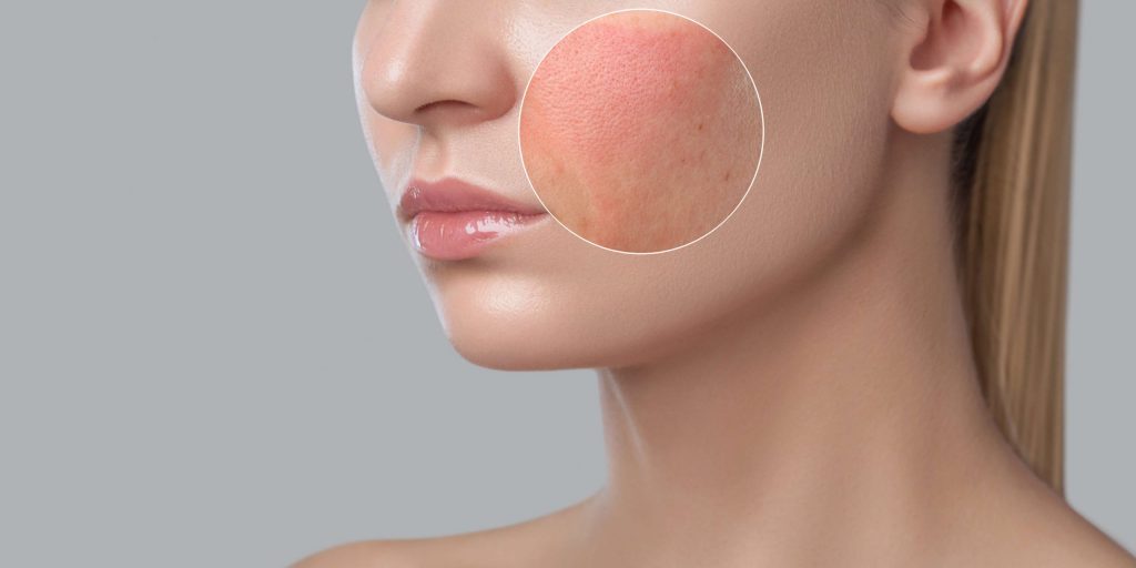 skin Allergy symptoms and causes